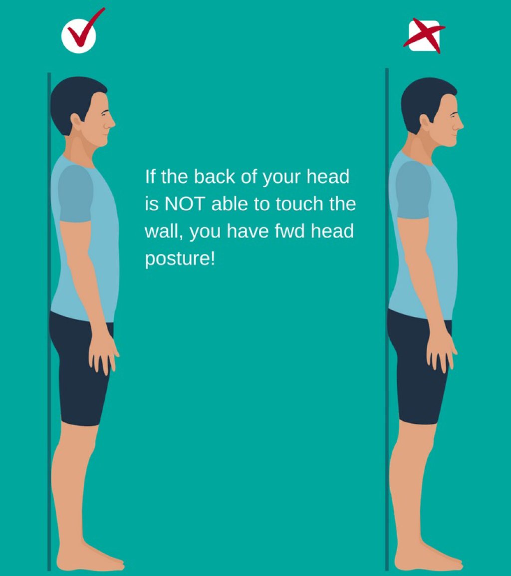 How do you know if you have Tech Neck? | Cornerstone Chiropractic